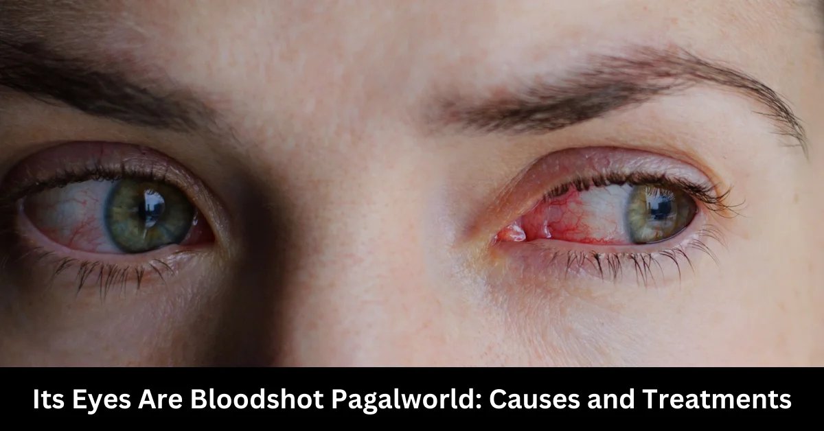 Its Eyes Are Bloodshot Pagalworld